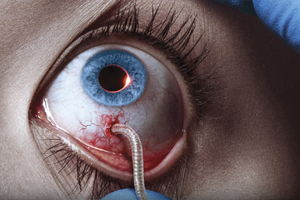 The Strain